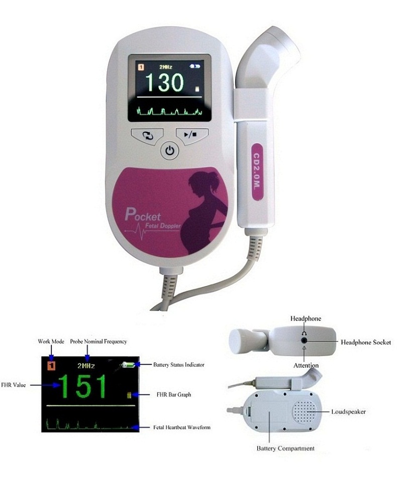 Fetal Doppler